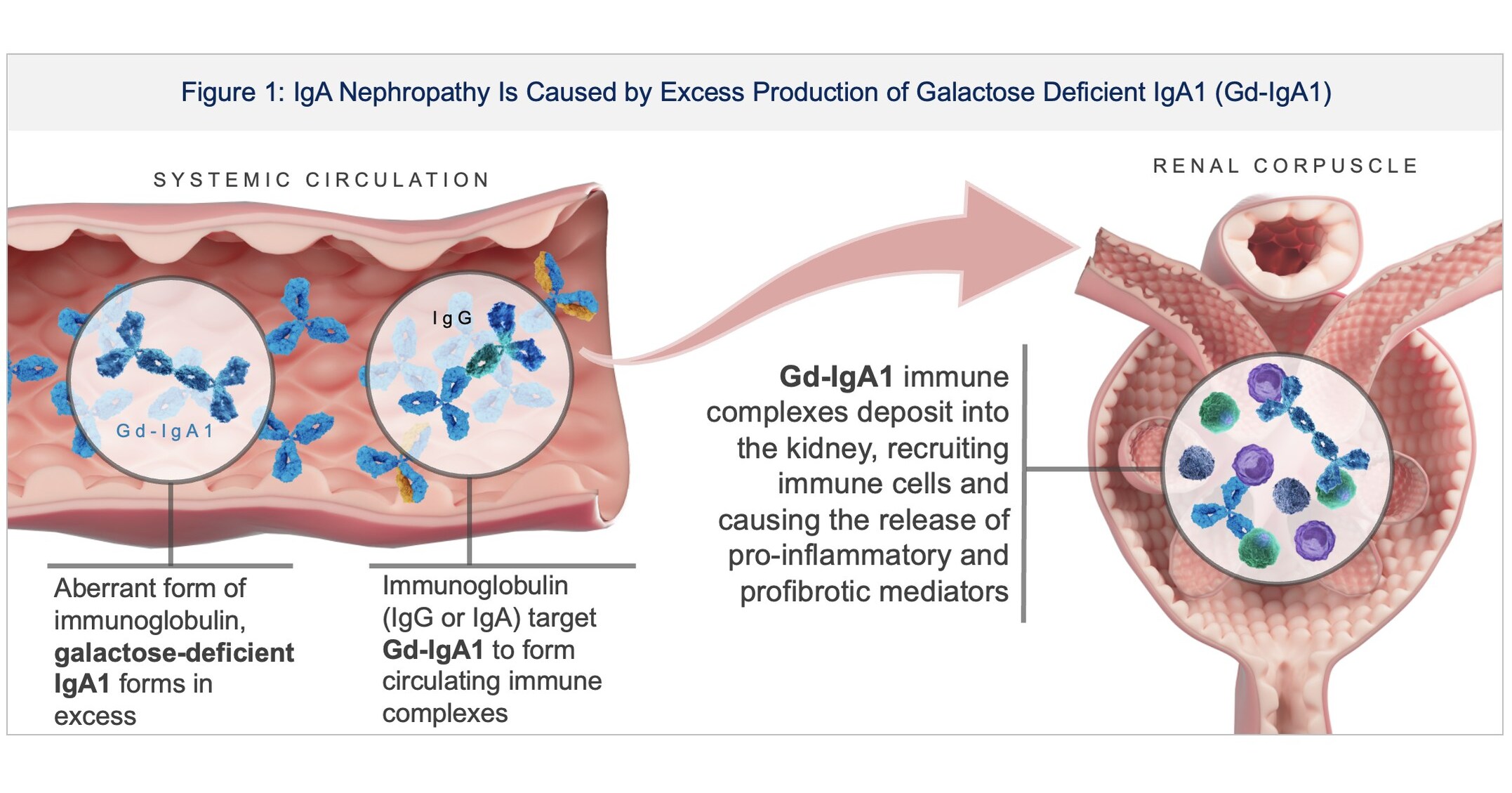 Biohaven Highlights Portfolio Progress, Innovation, and Anticipated Milestones at the 43rd Annual J.P. Morgan Healthcare Conference; Reports Positive Degrader Data with Rapid, Deep, and Selective Lowering of Galactose-Deficient IgA1 with Next Generation Potential Therapy for IgA Nephropathy